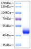 Recombinant Human ALK-4/ACVR1B Protein (RPCB0245)