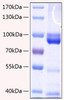 Recombinant Human AGER/RAGE Protein (RPCB0249)
