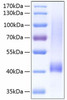 Recombinant Human Biglycan/BGN Protein (RPCB0252)