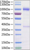 Recombinant Human GDNFR-alpha-1/GFRA1 Protein (RPCB0258)