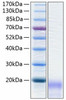 Recombinant Human CEACAM3/CD66d Protein (RPCB0267)