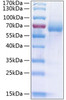 Recombinant Human LIMP II/SCARB2/CD36L2 Protein (RPCB0268)