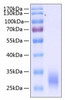 Recombinant Human Fc gamma RIIA/FCGR2A/CD32a (H167R) Protein (RPCB0275)