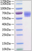 Recombinant Human BACE-1/ASP2 Protein (RPCB0277)