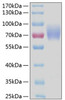 Recombinant Human FCAR/CD89 Protein (RPCB0279)