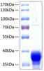 Recombinant Human Ephrin-B1/EFNB1 Protein (RPCB0283)