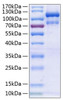 Recombinant Human EphA3 Protein (RPCB0285)