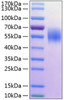 Recombinant Human MHC class I polypeptide-related sequence A/MIC-A Protein (RPCB0286)