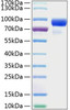 Recombinant Human Hedgehog-interacting protein/HHIP Protein (RPCB0289)