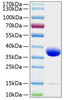Recombinant Human Prolactin receptor/PRL-R Protein (RPCB0294)