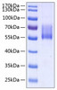 Recombinant Human MUC-1/CD227 Protein (RPCB0295)
