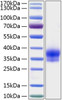 Recombinant Human IGFBP-6 Protein (RPCB0296)