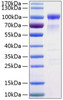 Recombinant Human SIRP-alpha/CD172a Protein (RPCB0297)