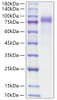 Recombinant Human Progranulin/PGRN/GRN Protein (RPCB0305)