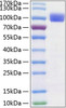 Recombinant Human TYRO3 Protein (RPCB0312)