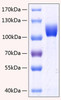 Recombinant Human FGFR-3 alpha (IIIc)/CD333 Protein (RPCB0315)