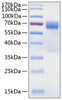 Recombinant Human TIM-3/HAVCR2/CD366 Protein (RPCB0318)