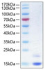 Recombinant Human Cystatin-M/CST6 Protein (RPCB0319)