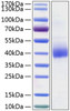 Recombinant Human CD301 Protein (RPCB0321)
