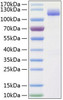 Recombinant Human ALCAM/CD166 Protein (RPCB0335)