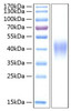 Recombinant Human TNFRSF1B/TNF-R2/CD120b Protein (RPCB0337)