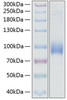 Recombinant Human L-Selectin/SELL/CD62L Protein (RPCB0338)
