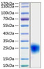 Recombinant Human Cripto-1/TDGF1 Protein (RPCB0341)
