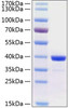 Recombinant Human Arginase 1/ARG1 Protein (RPCB0346)