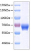 Recombinant Human Ephrin-B1/EFNB1 Protein (RPCB0350)