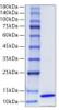 Recombinant Human CCL17/TARC Protein (RPCB0360)