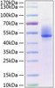 Recombinant Human Dkk-3 Protein (RPCB0361)
