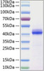 Recombinant Human CD5L Protein (RPCB0368)