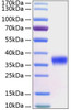 Recombinant Human Kallikrein-8/KLK8 Protein (RPCB0369)