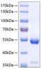 Recombinant Human Carboxypeptidase E/CPE Protein (RPCB0372)