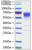 Recombinant Human Activin RIIB/ACVR2B Protein (RPCB0375)