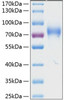 Recombinant Human NKAT-2/KIR2DL3/CD158b2 Protein (RPCB0389)