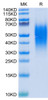 Recombinant Human B7-H5/Gi24/VISTA Protein (RPCB0392)