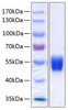 Recombinant Human Serpin A1/Alpha-1-antitrypsin Protein (RPCB0403)