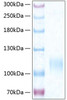 Recombinant Human E-selectin/SELE/CD62E Protein (RPCB0404)