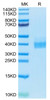 Biotinylated Recombinant Human B7-H1/PD-L1/CD274 Protein (RPCB0405)