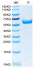 Recombinant Human TREM2 Protein (RPCB0413)
