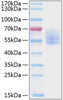 Recombinant Human Podoplanin/PDPN Protein (RPCB0416)