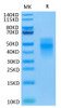 Recombinant Human TREM-1/CD354 Protein (RPCB0431)