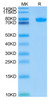 Recombinant Human Siglec-8 Protein (RPCB0432)