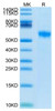 Biotinylated Recombinant Human Siglec-8 Protein (RPCB0433)