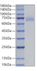 Recombinant Human DLL4 Protein (RPCB0440)