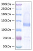Recombinant Human Thrombospondin-5/COMP Protein (RPCB0447)