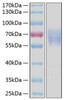 Recombinant Human LMIR1/CD300a Protein (RPCB0449)