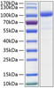 Recombinant Human CSF3R/G-CSF-R/CD114 Protein (RPCB0454)