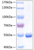 Recombinant Human Retinol-binding protein 4/PRBP Protein (RPCB0455)